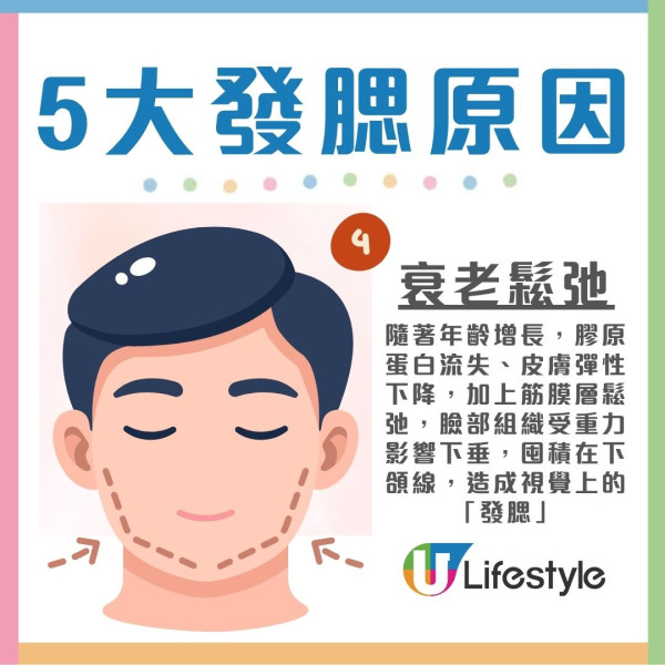 發腮解決︱年紀大臉變寬變方?日本專家教1招逆轉國字臉 附5大發腮原因解決方法