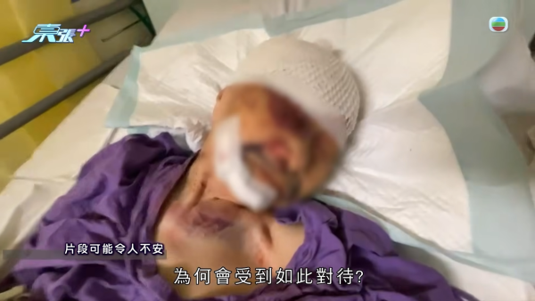 长期卧床不可能跌倒！慈云山养老院百岁老妇重伤缝9针！惊揭同房院友伤人恐怖悲剧