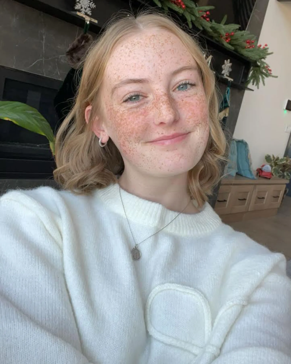 戴隱形眼鏡沖涼出事!美國20歲女感染食腦阿米巴變形蟲 雙眼一度失明一年未康復