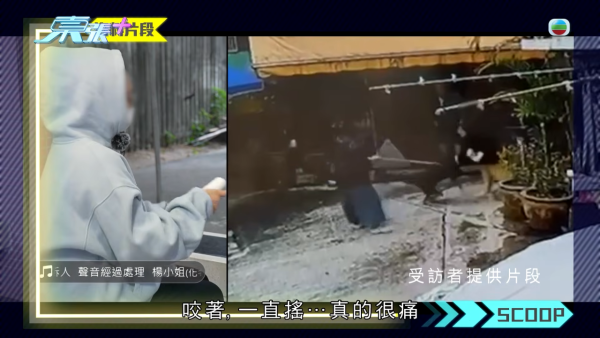 元朗村屋惡犬撕咬恐怖慘劇苦主現身 手指縫6針變形 患創傷後遺症長期於青山醫院覆診