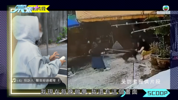元朗村屋惡犬撕咬恐怖慘劇苦主現身 手指縫6針變形 患創傷後遺症長期於青山醫院覆診