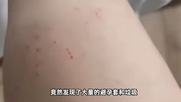 男子入住內地酒店聞異味全身痕!驚揭床底藏滿用過避孕套+垃圾 酒店要求「自證」才會賠償