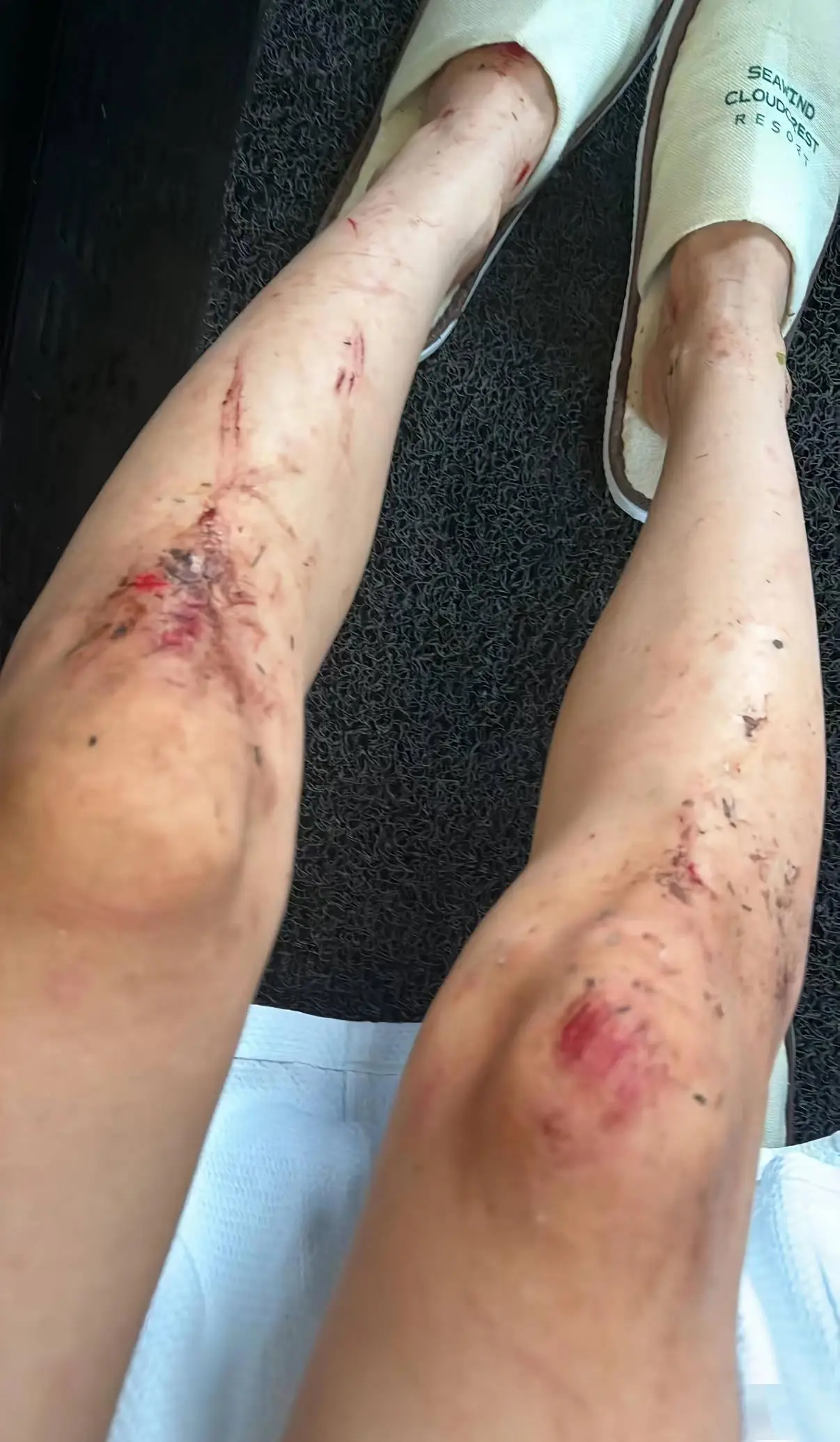 25歲中國女住大馬渡假村遭闖入!半夜房內險遭性侵 逃脫後躲叢林等候救援