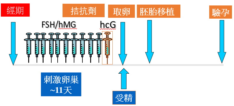 瑪麗醫院試管嬰兒（IVF）療程4大步驟（圖片來源︰瑪麗醫院）