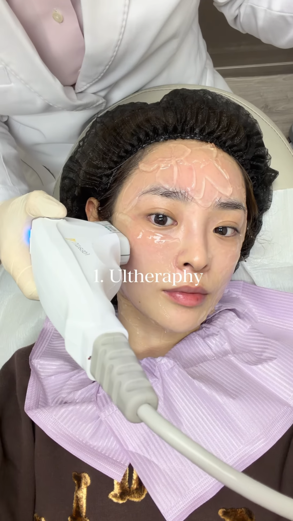 陈桢怡震撼公开韩国医美过程，曝光真面目！素颜惊现欧式双眼皮与丰唇神奇进化