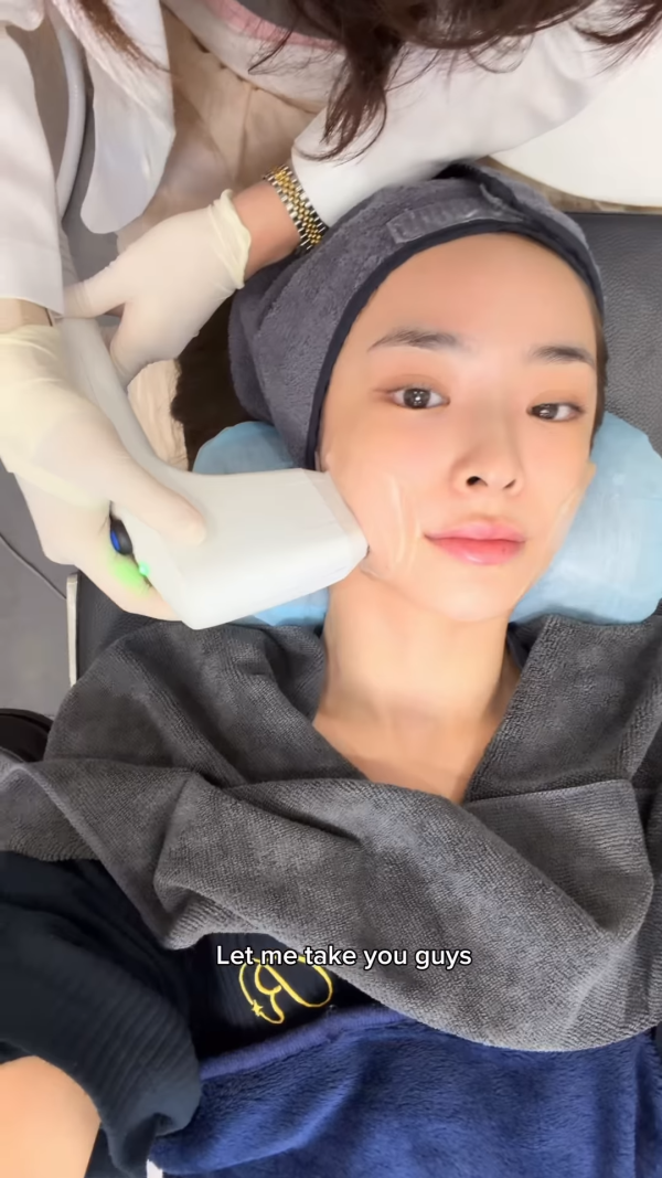 陈桢怡震撼公开韩国医美过程，曝光真面目！素颜惊现欧式双眼皮与丰唇神奇进化