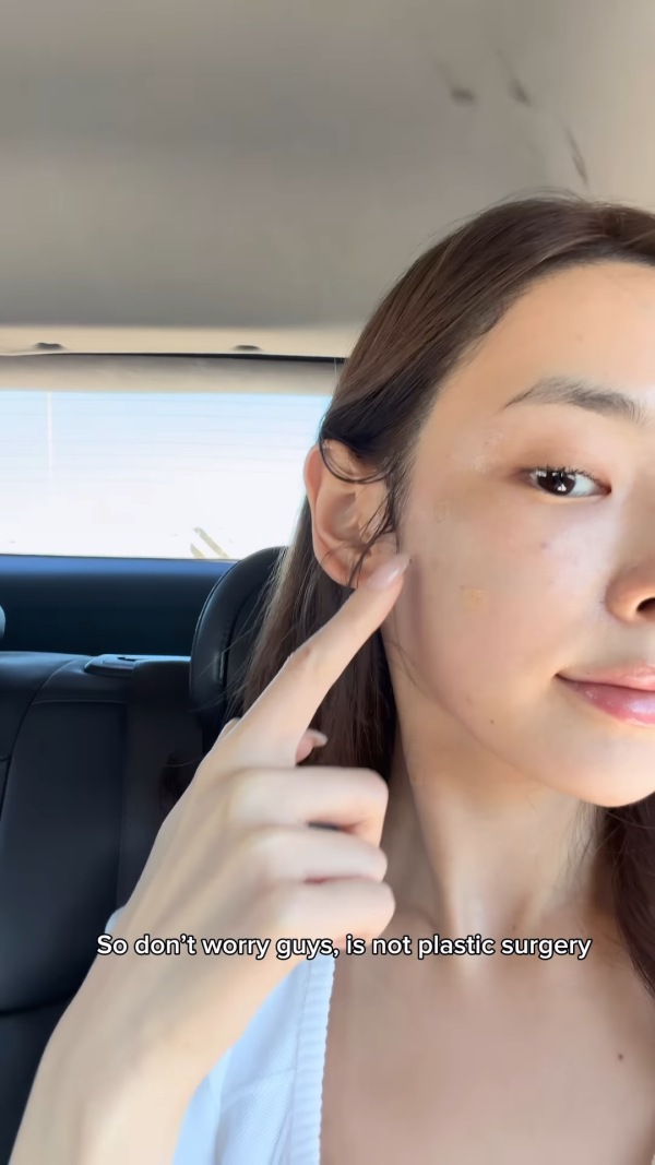 陈桢怡震撼公开韩国医美过程，曝光真面目！素颜惊现欧式双眼皮与丰唇神奇进化
