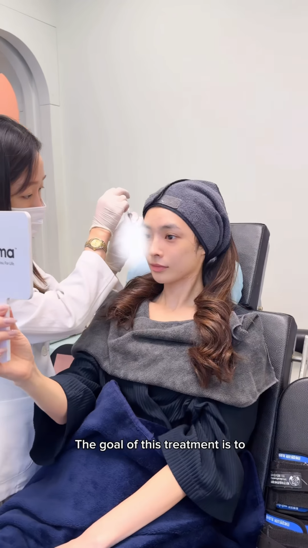 陈桢怡震撼公开韩国医美过程，曝光真面目！素颜惊现欧式双眼皮与丰唇神奇进化