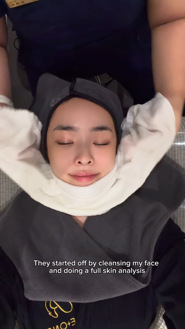 陈桢怡震撼公开韩国医美过程，曝光真面目！素颜惊现欧式双眼皮与丰唇神奇进化