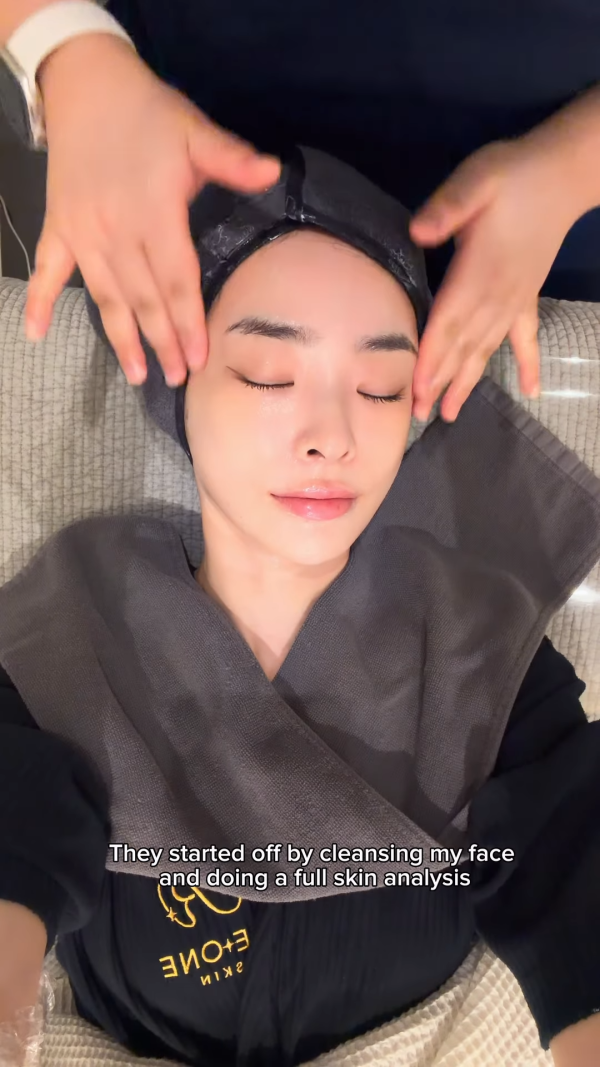 陈桢怡震撼公开韩国医美过程，曝光真面目！素颜惊现欧式双眼皮与丰唇神奇进化