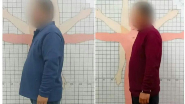 62歲男靠聽醫生1句3個月瘦37kg！醫生叮嚀健康瘦關鍵／長期病藥也停了