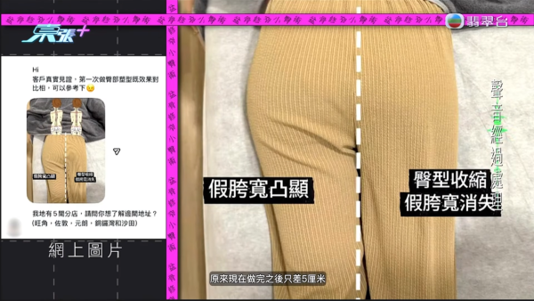 港女試做$268美容療程慘變左腦中風！疑遭按摩師拉扯肩頸致血管撕裂 身體抽搐麻痹入院