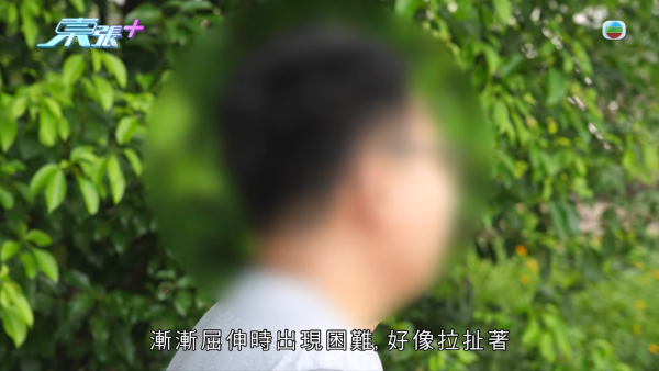港男北上求醫「彈弓指」慘變中指永久殘廢！恐怖醫療陷阱！港醫證肌腱已遭過度切除