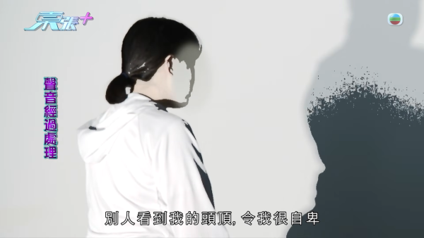 港女17岁起脱发受尽折磨！4000元再生纹发惊变烂头皮触目惊心 揭美容院颜料疑似淘宝同款