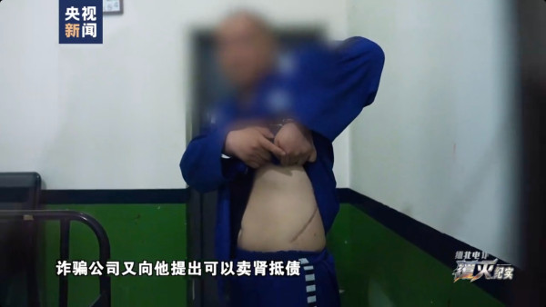 緬北電騙園區駭人黑幕曝光 內地男業績欠佳遭毒打兼「割腎抵債」
