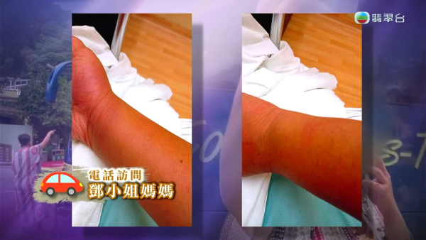 大围“火爆姐”人肉挡车被强制送院！风波大逆转悲惨身世曝光 昔日闺蜜揭停药失控真相