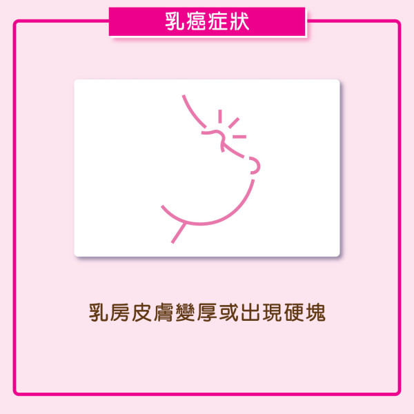 【粉紅10月】乳癌不會響警報!佘詩曼呼籲定期檢查 捐$170即送磁吸卡套 為乳癌患者送乳癌復康包