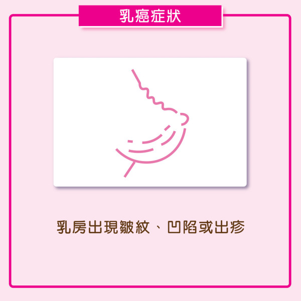 【粉紅10月】乳癌不會響警報！佘詩曼呼籲定期檢查 捐$170即送磁吸卡套 為乳癌患者送乳癌復康包