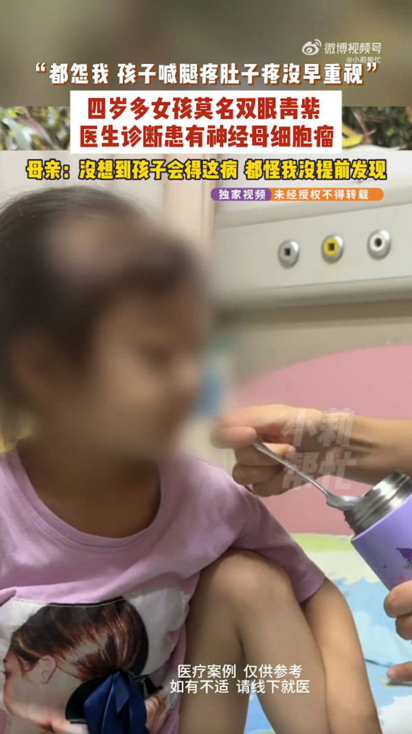 4歲童雙眼現黑眼圈竟確診癌王！其母以為捱夜玩電話忽視痛心自責