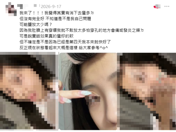 网传撒隆巴斯加盐放肚脐治麦粒肿！网友实测：隔日即消肿！中西医警告恐发炎或致腹膜炎