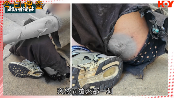 有線採訪車「尿袋」自燃燒傷攝影師　事主：無預警突然起火　代理商緊急停售涉事型號