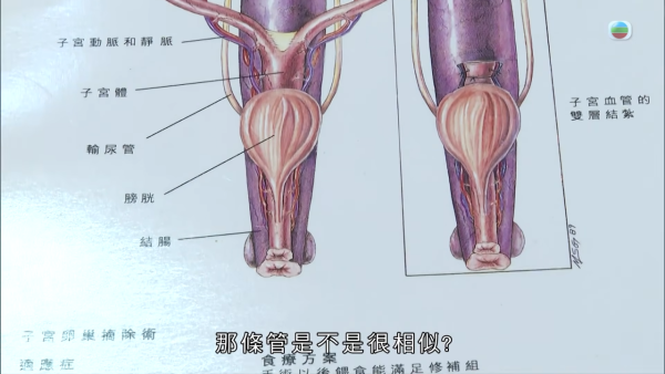 深水埗獸醫診所驚爆無牌行醫黑幕 布偶貓絕育後慘死  絕密錄音揭誤將膀胱當子宮切除