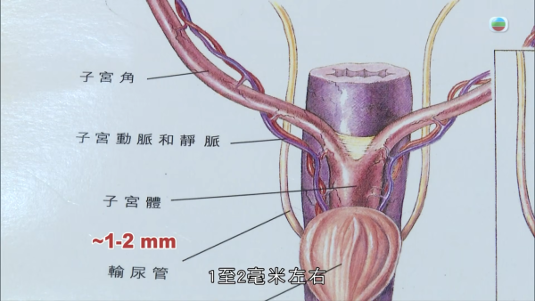 深水埗獸醫診所驚爆無牌行醫黑幕 布偶貓絕育後慘死  絕密錄音揭誤將膀胱當子宮切除