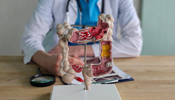 23歲女運動員竟確診大腸癌！作息正常無血便無家族史／醫嘆做到1事幸保性命