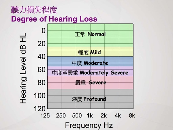 入耳式耳機「無咁傷耳」？ 聽力專家：降噪耳機可保護聽覺