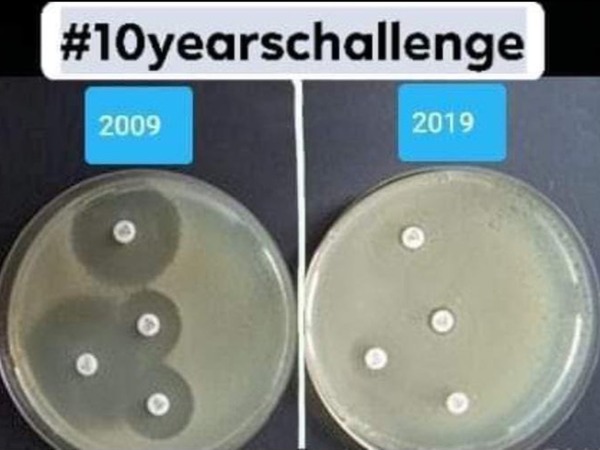 倫敦醫生分享細菌版 10 Years Challenge！濫用抗生素有害無益