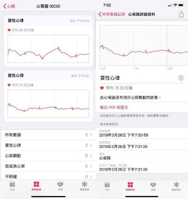 Apple Watch 心電圖功能香港有得用！檢測心房顫動透視心臟健康問題