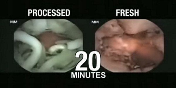 即食麵難消化？食落肚 2 小時仍見原形【有片睇】