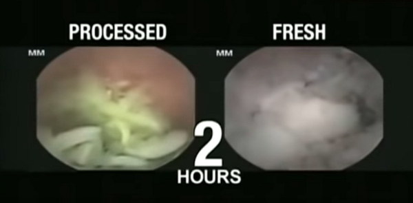 即食麵難消化？食落肚 2 小時仍見原形【有片睇】