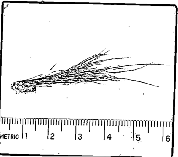  FBI 公開調查報告　大腳八毛髮竟然來自......