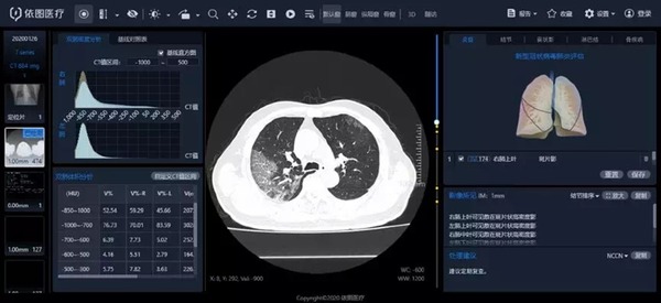 上海醫院使用 AI 系統 加快診斷武漢肺炎速度