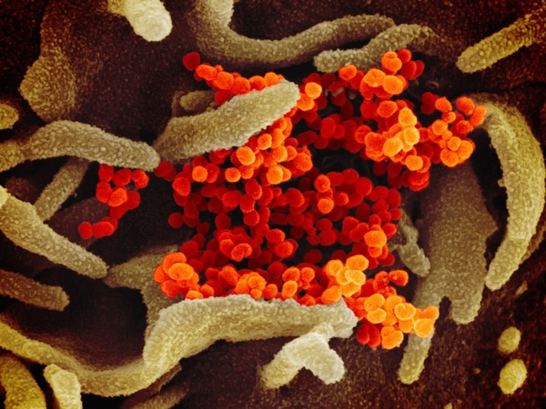 【新冠肺炎】美國專家展示新型冠狀病毒真貌  似足 SARS 及 MERS？