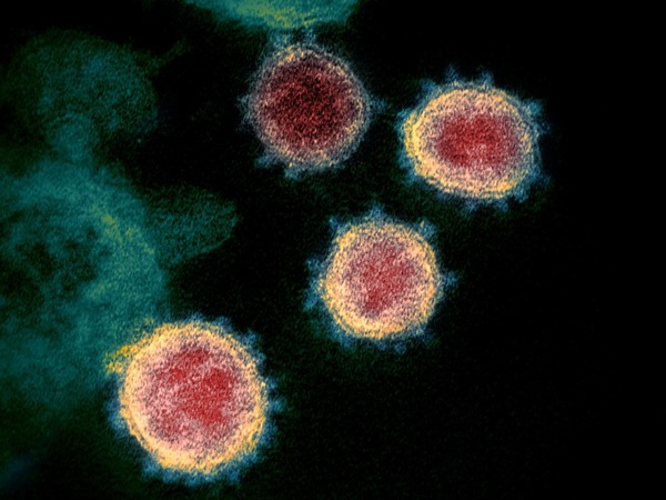 【新冠肺炎】美國專家展示新型冠狀病毒真貌  似足 SARS 及 MERS？