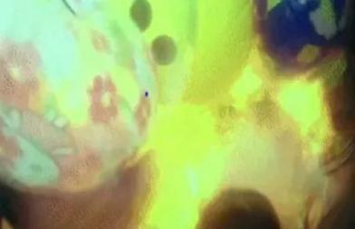 電梯內點打火機氫氣球秒爆   致 5 人燒傷
