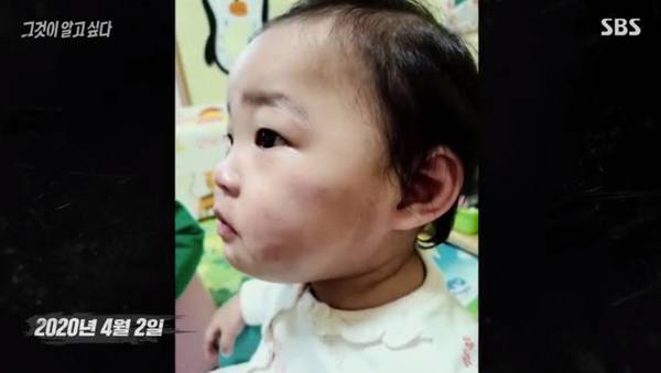 16 月大女嬰疑遭虐待至死震驚韓國！有心人 3 度申報虐兒不果惹爭議