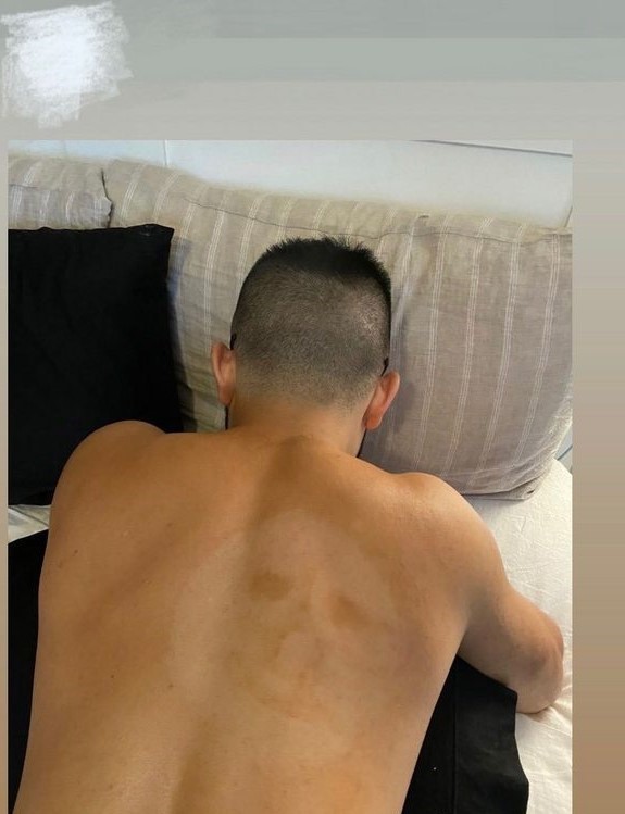 面膜貼老公背數分鐘「長出」白臉  網民重點問面膜牌子