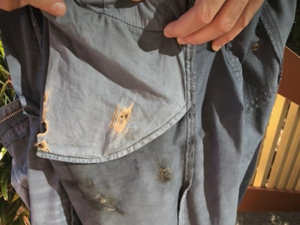 墨爾本男子 iPhone X 爆炸致大腿 2 級燒傷  事後控告 Apple 索償
