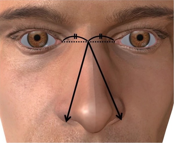 日本醫科大學最新研究  男性鼻子愈大生殖器官愈長