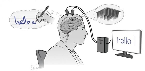 癱瘓者腦中植入感測器  憑意念打字準確率近 100％