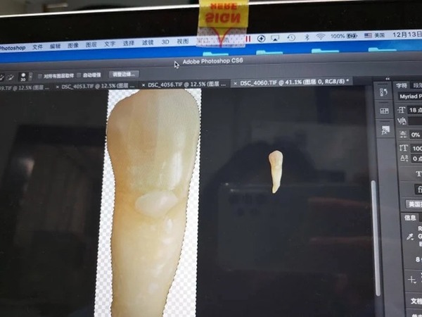 【離不開的牙】電腦螢幕離奇出現牙齒 女網民無法刪掉求救