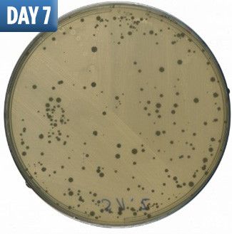 研究發現由第7日起，培養皿已有部分細菌生長。