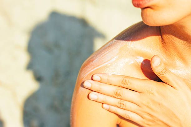 3.曬傷脫皮：  把軟膏輕輕塗抹於脫皮位置能舒緩因曬傷引起的痛楚及改善脫皮狀況。