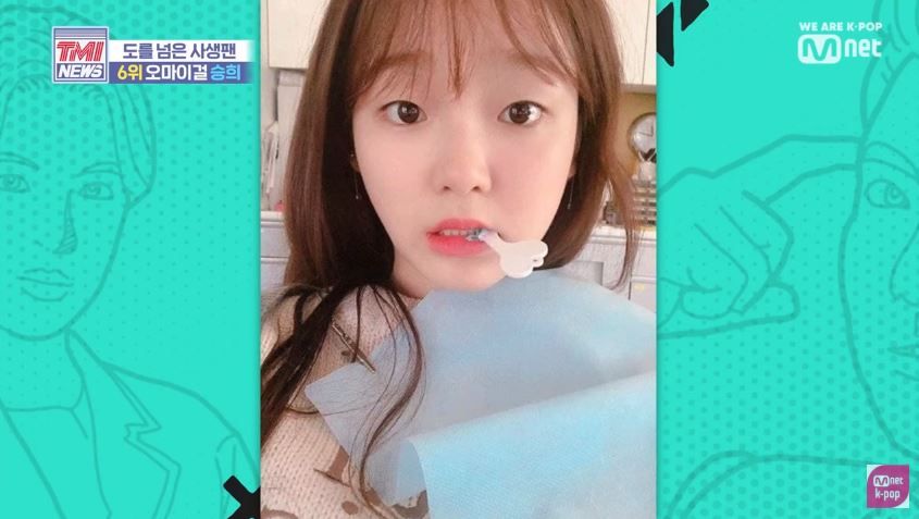 Oh My Girl勝熙公開牙套照。