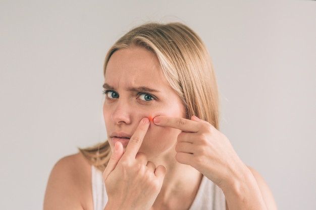 暗瘡懶人包:額頭/下巴生暗瘡=內分泌失調?拆解5大暗瘡位置身體警號 + 去暗瘡方法