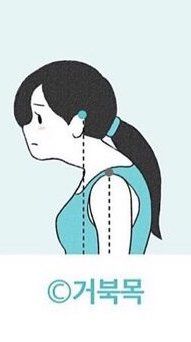 C：嚴重寒背。放輕鬆站立時，頭部未能貼牆，而且頸椎有明顯前傾問題。同時，耳朵頂端點與肩膀的距離約有5cm或以上的差距，表示你可能出現相當嚴重的「烏龜頸」了。