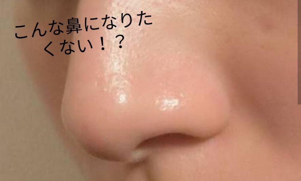 Tips2:卸妝油塗敷鼻子及下巴位置。